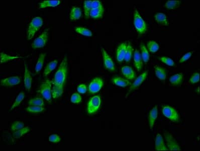 IHC-plus™ Junctin / ASPH Antibody