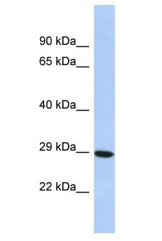 Polyclonal Rabbit anti-Human ASIC1 / ACCN2 Antibody (aa38-87, WB)