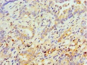 SPN / CD43 Antibody (aa276-400)