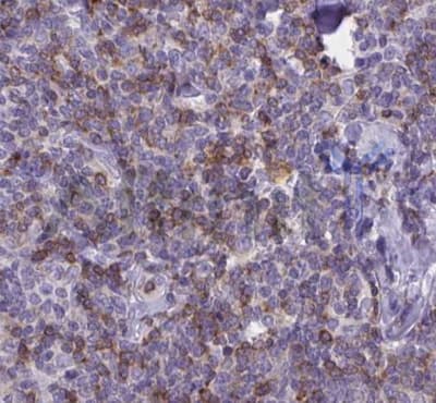 IL8 / Interleukin 8 Antibody