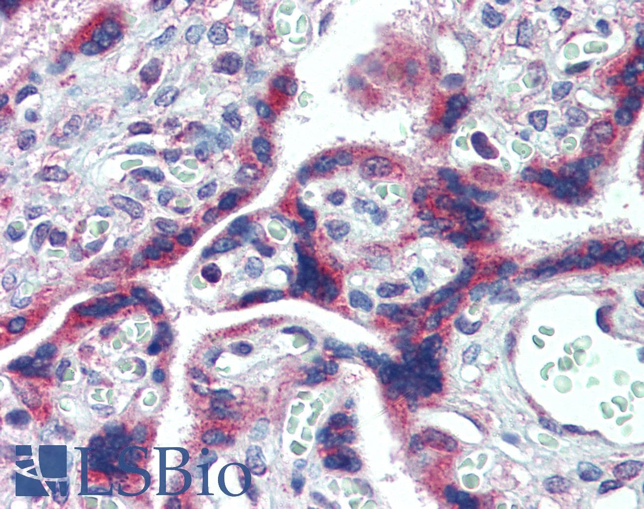IHC-plus™ FMR1 / FMRP Antibody (aa594-607)