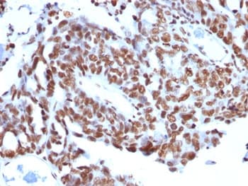Histone H1 Antibody (clone SPM256)