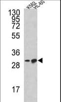 IHC-plus™ Polyclonal Rabbit anti-Human BCL2L11 / BIM Antibody (aa134-160, IHC, WB)