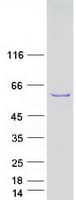 Human TBL1Y / TBL1 Protein (Recombinant Myc-DDK (Flag))