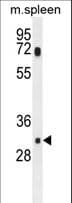 SLC25A51 / MCART1 Antibody (aa46-75)