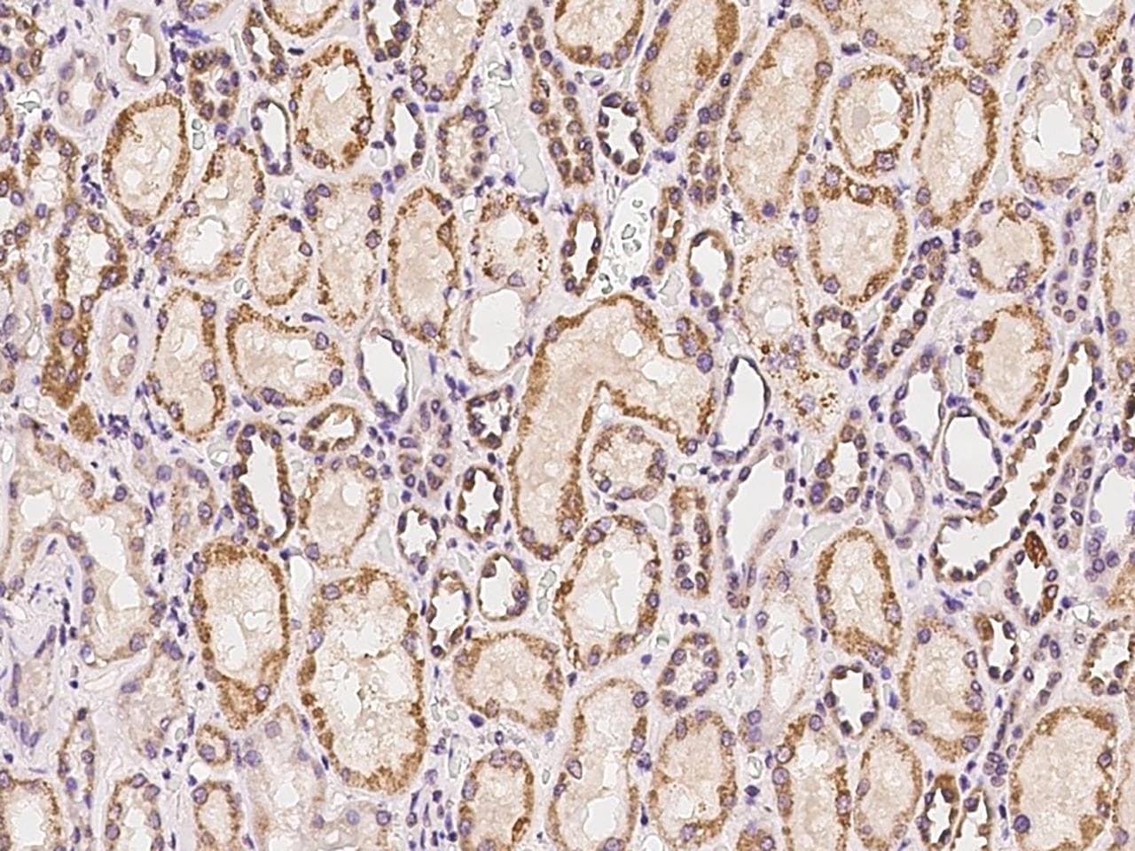 HTR2C / 5-HT2C Receptor Antibody