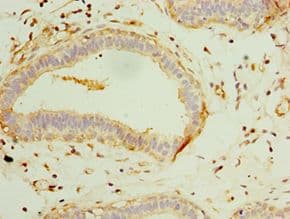 Polyclonal Rabbit anti-Human GCP3 / TUBGCP3 Antibody (aa1-250, IHC)