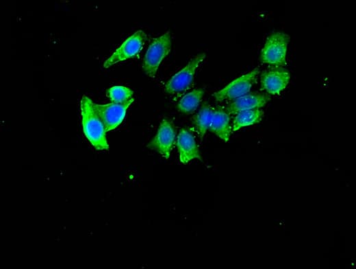 Polyclonal Rabbit anti-Human DDA1 Antibody (IHC, IF, WB)