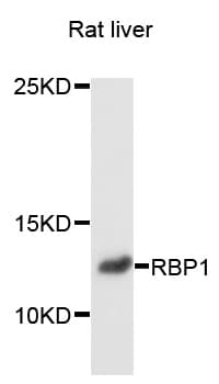 Polyclonal Rabbit anti-Human RBP1 / CRBP Antibody (WB)