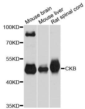 CKB / Creatine Kinase BB Antibody