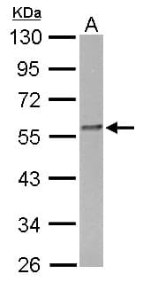 FKBP4 / FKBP52 Antibody (aa1-207)