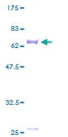 Human SERPINB9 / PI9 Protein (Recombinant GST)