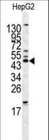 HOMER1 / Homer 1 Antibody (aa96-122)