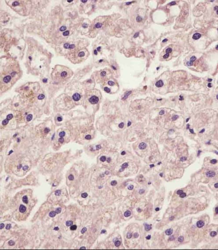IL1RAP Antibody (C-Terminus)