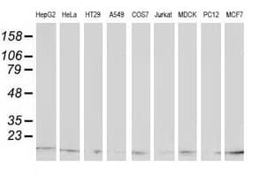 IHC-plus™ Monoclonal Mouse anti-Human ATP6V1F Antibody (clone 5F10, IHC, IF, WB)