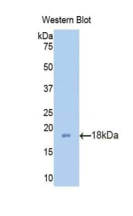 PFN2 / Profilin 2 Antibody (aa5-140)