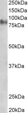 IHC-plus™ JUP/CTNNG/Junction Plakoglobin Antibody (aa732-745)