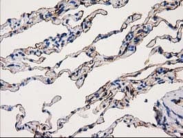 ANXA3 / Annexin A3 Antibody (clone OTI5G4)