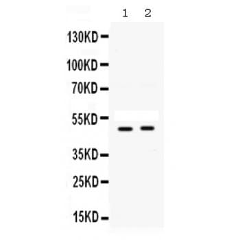 SFRP4 Antibody (aa22-303)