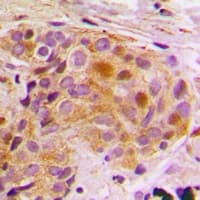 STAT5B Antibody