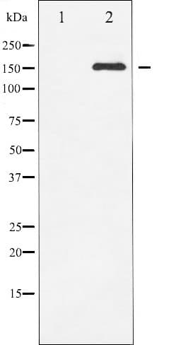 KDR / VEGFR2 / FLK1 Antibody (phospho-Tyr951)