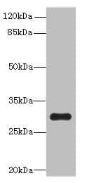 Polyclonal Rabbit anti-Human OVOL1 Antibody (IHC, WB)