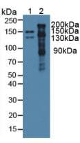 THBS1 / Thrombospondin-1 Antibody (aa515-671)