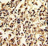 Polyclonal Rabbit anti-Human SERPINA9 Antibody (aa194-222, IHC, WB)