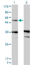Monoclonal Mouse anti-Human MMP13 Antibody (clone 3B11, WB)