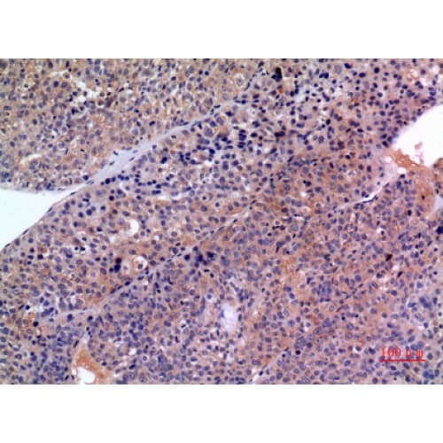 Polyclonal Rabbit anti-Human SERPINB3 Antibody (101-150 aa, Internal, IHC, WB)