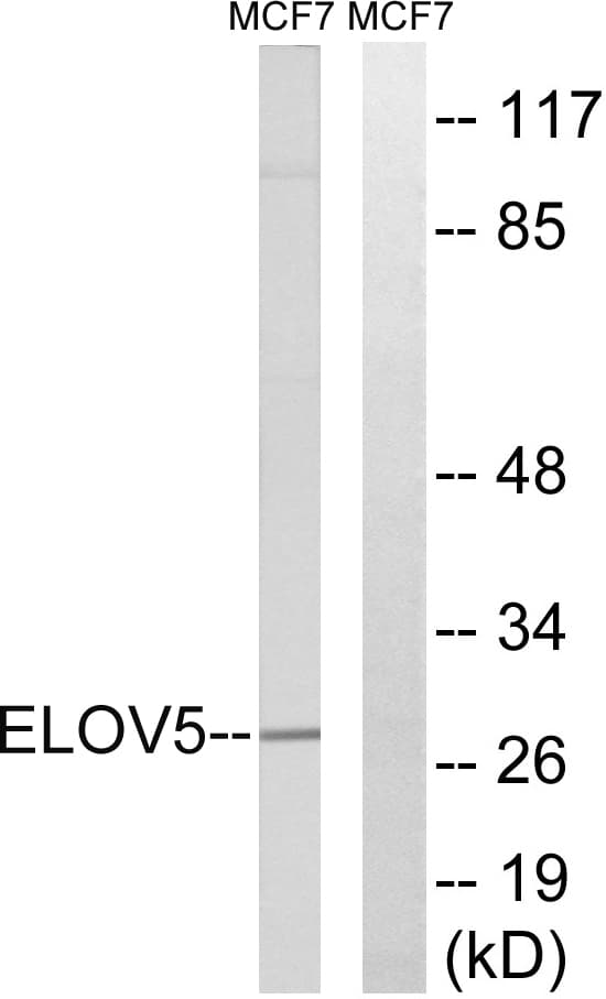IHC-plus™ HELO1 / ELOVL5 Antibody (aa250-299)