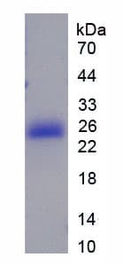 Rat HMGB4 Protein (Recombinant His, N-Terminal)