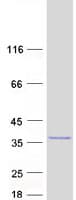 Human C11orf53 Protein (Recombinant Myc-DDK (Flag))