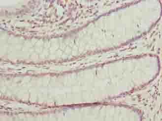 BUD31 Antibody