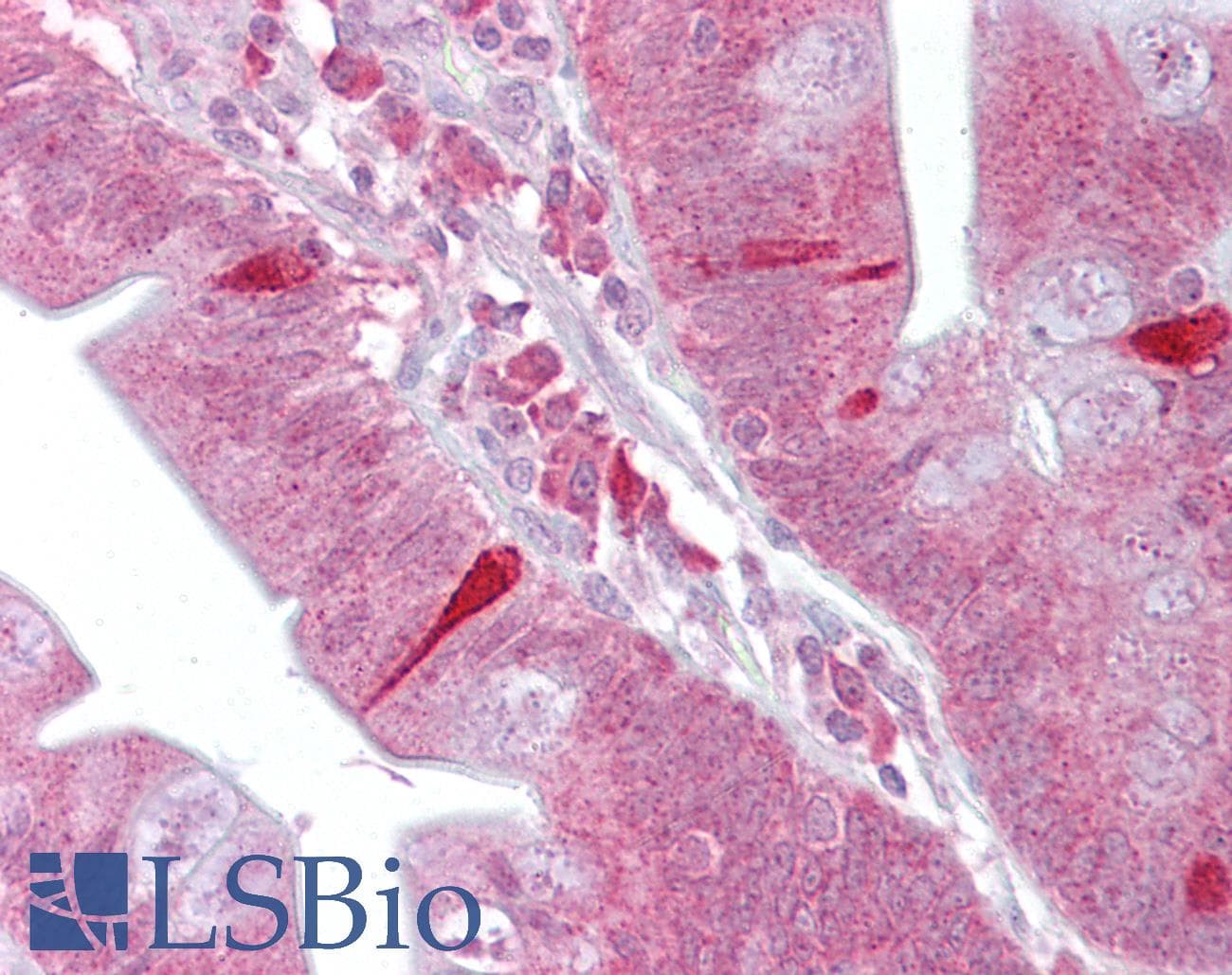 ATF4 Antibody (N-Terminus)