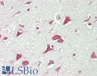 IHC-plus™ Polyclonal Rabbit anti-Human NRXN3 Antibody (aa516-555, IHC, WB)