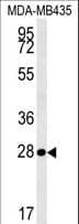 MRM1 Antibody (aa80-109)