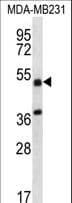 Polyclonal Rabbit anti-Human TRIM10 Antibody (aa410-438, WB)