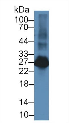 LAT2 / NTAL Antibody (aa32-192)