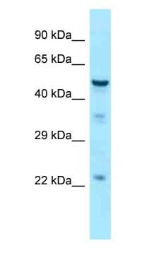TUBB3 / Tubulin Beta 3 Antibody (C-Terminus)