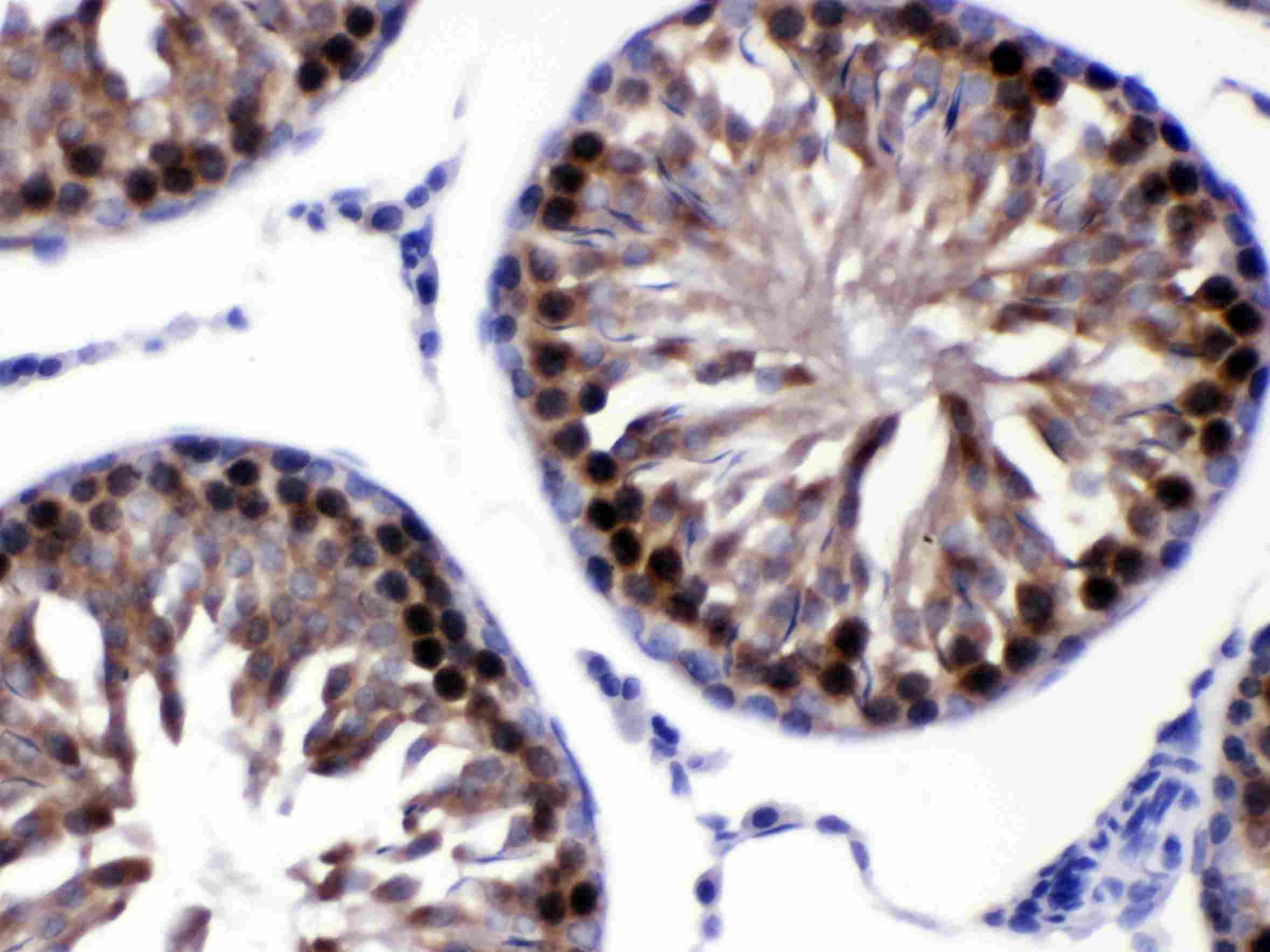 CACYBP Antibody