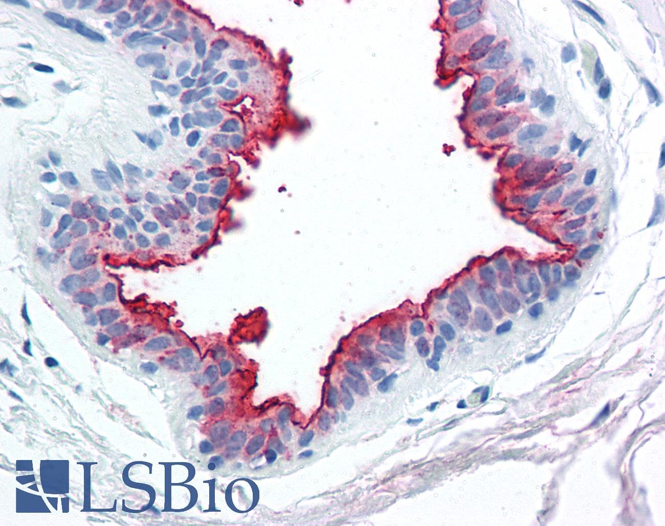 PathPlus™ EMA / MUC1 Antibody (clone ABT-EMA)