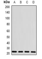 GHBP / BLVRB Antibody