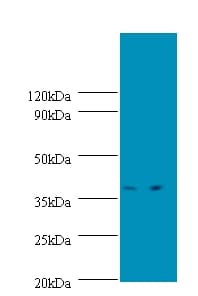 SPT3 / SUPT3H Antibody