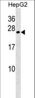 CRYGB Antibody (aa68-97)