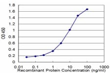 CML / BCR Antibody (clone 2E5)