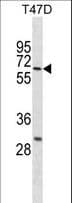 DDX41 / ABS Antibody (aa141-169)