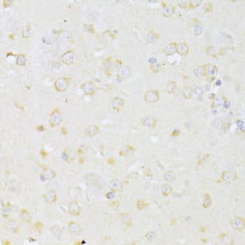 Polyclonal Rabbit anti-Human CHRNA7 Antibody (IHC, WB)