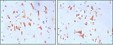 FMR1 / FMRP Antibody (clone 4G9)