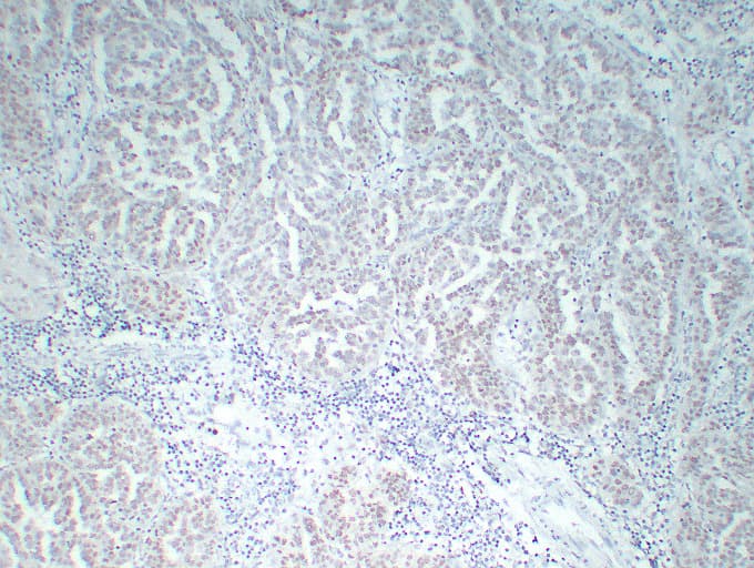 WT1 / Wilms Tumor 1 Antibody (clone ABT-WT1)